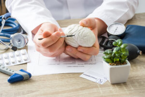 You Have a Limited Time to Seek Compensation After Suffering a Brain Injury in California